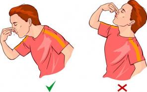 Como parar hemorragias nasais
