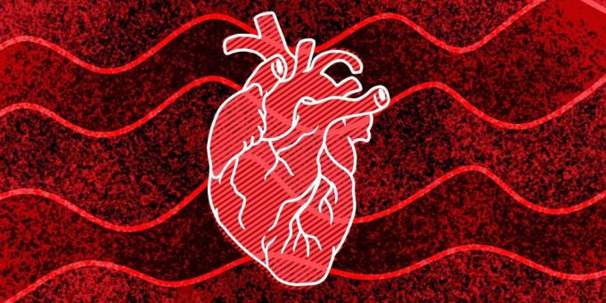 11 sinais de que você pode acontecer parada cardíaca