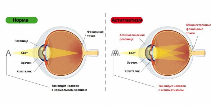 Visão de uma pessoa com e sem astigmatis