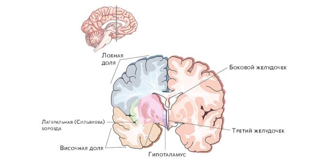 Ventrículos cerebrais. O acúmulo de líquido neles leva à hidrocefalia.