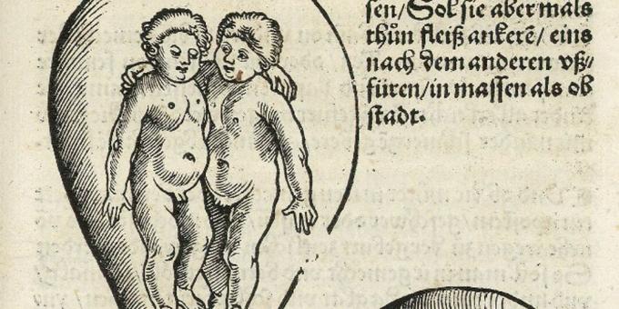 Filhos da Idade Média: gêmeos no útero, Eucharius Rodion