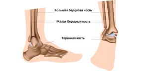 Como reconhecer uma fratura de tornozelo e o que fazer a seguir