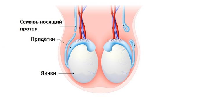 Vasectomia